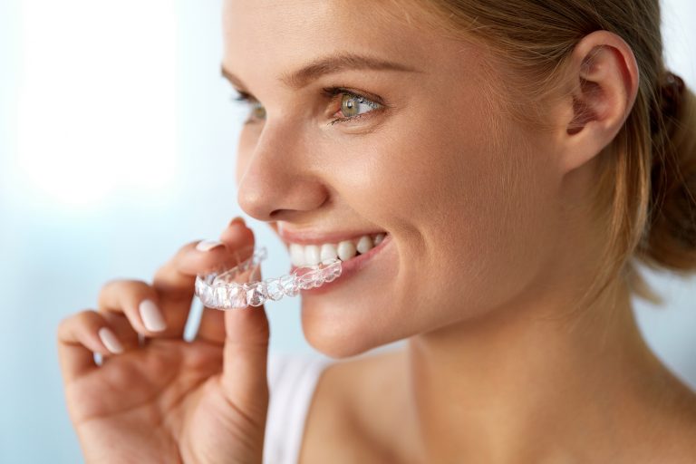 Smiling woman holding and inserting an Invisalign clear aligner for teeth straightening
